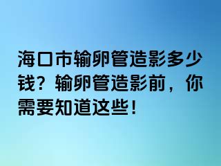 ?？谑休斅压茉煊岸嗌馘X？輸卵管造影前，你需要知道這些！